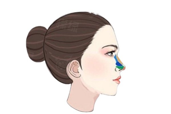 優(yōu)妮金玻尿酸適合打哪里www.sanboo.cn