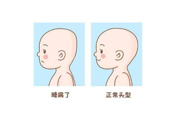 有人做過后腦勺填充手術(shù)嘛www.sanboo.cn20241224992807.jpg