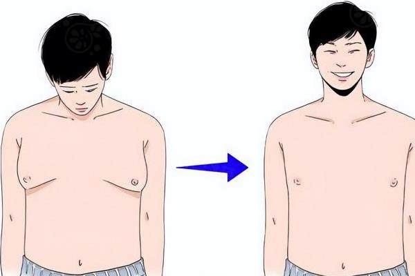 男性胸部肥大做什么手術(shù)好www.sanboo.cn