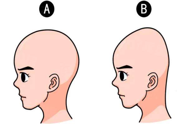 國內(nèi)后腦勺填充的醫(yī)院哪家好okostu.com