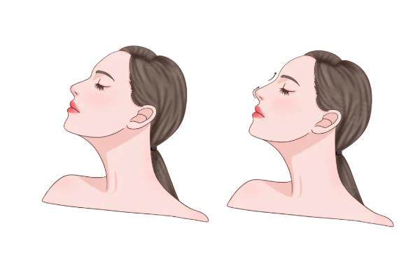 西安曾熬醫(yī)生做鼻子怎么樣www.sanboo.cn