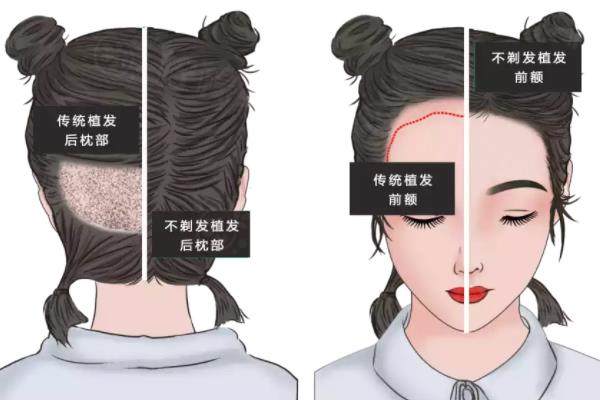 碧蓮盛植發(fā)正規(guī)嗎www.sanboo.cn