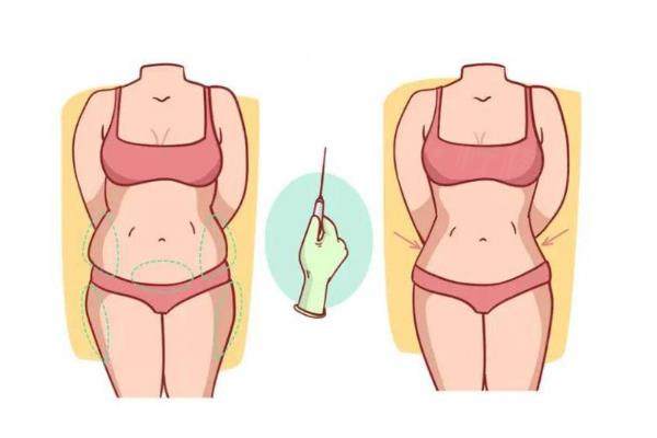 分享大腿吸脂肪的全過程,1周就可正常走路,還有大腿吸脂手術(shù)后的真實(shí)感受！okostu.com