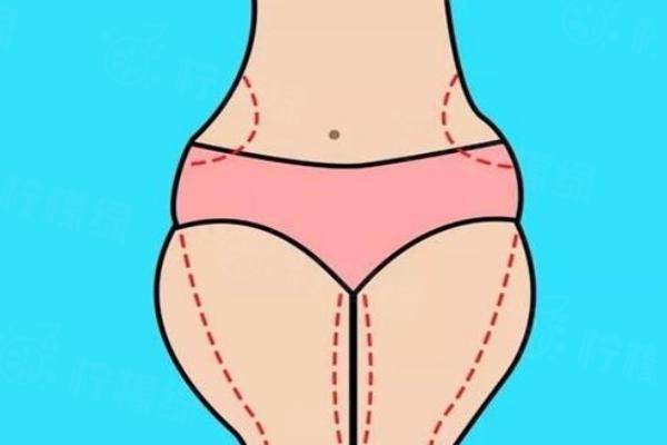 分享大腿吸脂肪的全過程,1周就可正常走路,還有大腿吸脂手術(shù)后的真實(shí)感受！okostu.com