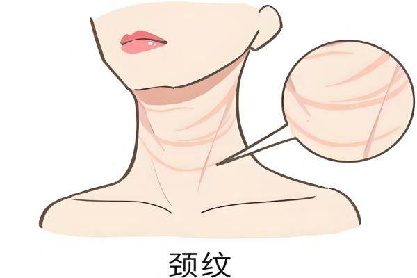 潤致格格針有什么療效？okostu.com