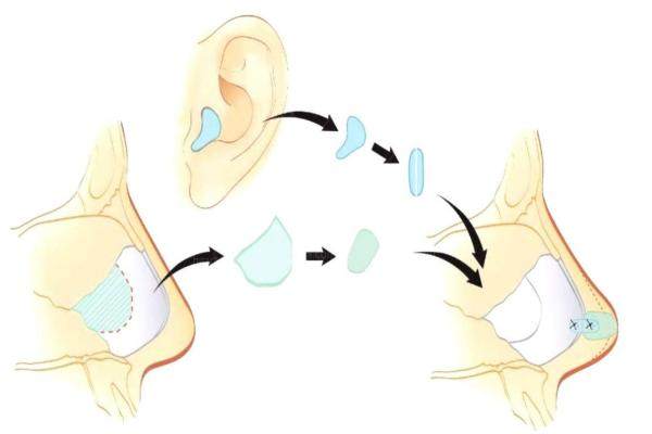 段偉強(qiáng)醫(yī)生在哪個(gè)醫(yī)院www.sanboo.cn