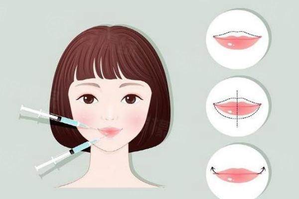 嘴巴打了玻尿酸還可以做m唇嗎www.sanboo.cn