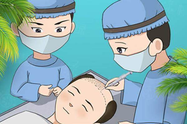 剃發(fā)植發(fā)和不剃發(fā)植發(fā)哪個<span style=