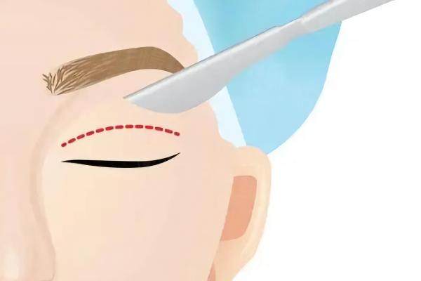 武漢方濤眼修復(fù)醫(yī)生怎么掛號www.sanboo.cn