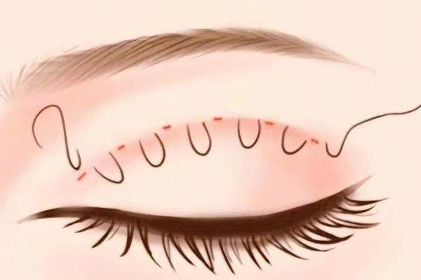 武漢方濤眼修復(fù)醫(yī)生怎么掛號www.sanboo.cn