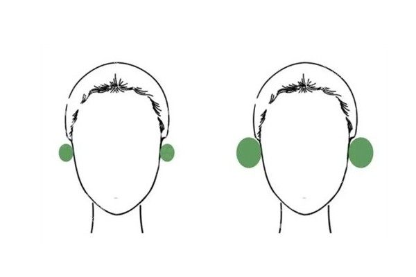 貼面耳怎么改善www.sanboo.cn