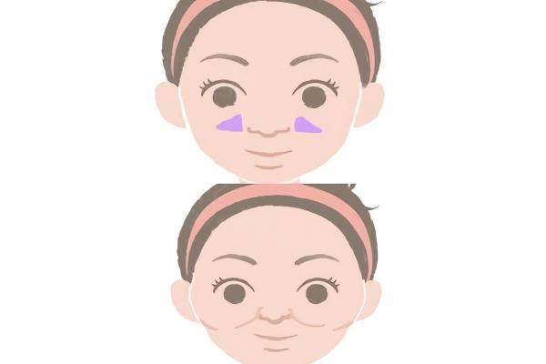 adm填充鼻基底能維持多久www.sanboo.cn