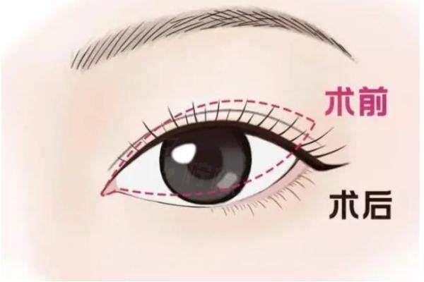 美杜莎電眼技術(shù)okostu.com