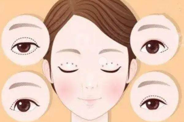 深圳朱武根做美杜莎雙眼皮okostu.com