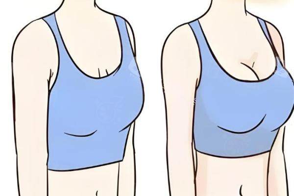 唐志榮醫(yī)生隆胸怎么樣，內(nèi)窺鏡雙平面’隆胸技術(shù)好okostu.com