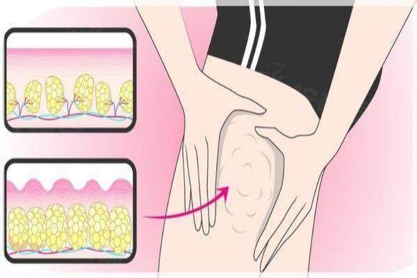 重慶馮牧夷抽脂怎么樣www.sanboo.cn