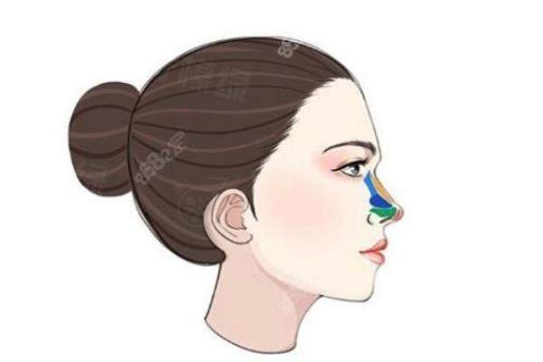 裴柄萬(wàn)做鼻子怎么樣？裴柄萬(wàn)做ARSMO軟骨鼻2.0創(chuàng)口小+修復(fù)快，能維持5-10年okostu.com