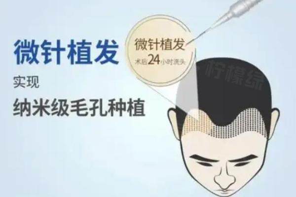 【真實(shí)體驗(yàn)】成都大麥微針植發(fā)靠譜，正規(guī)資質(zhì)|蔣任才醫(yī)生技術(shù)好okostu.com