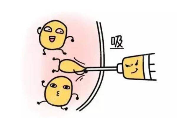 土麥森吸脂跟正常吸脂的區(qū)別www.sanboo.cn