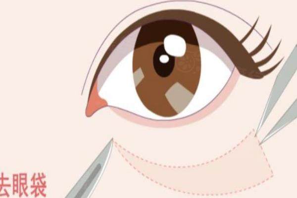 張晉寶醫(yī)生眼袋手術(shù)怎么樣？不開刀去眼袋技術(shù)好（價(jià)格在2萬(wàn)起）okostu.com