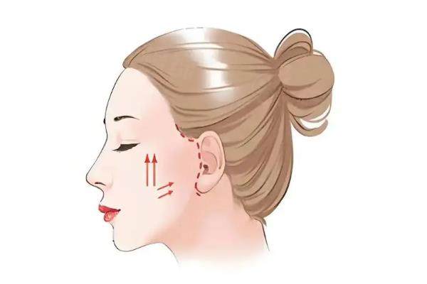 深圳拉皮醫(yī)生排名!曹孟君小切口/楊建榮筋膜提升/袁強微創(chuàng)拉皮誰更強？www.sanboo.cn