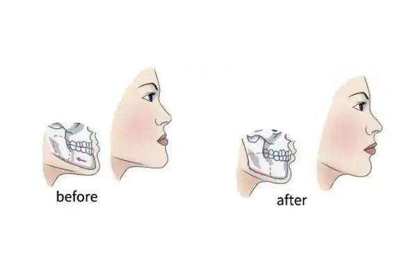 周會(huì)喜在哪家醫(yī)院www.sanboo.cn