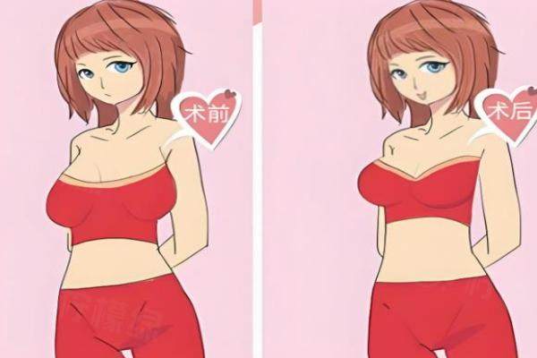 國(guó)內(nèi)做縮胸手術(shù)醫(yī)院排名前十okostu.com