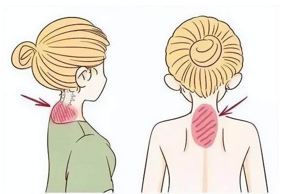 富貴包能消除掉嗎?揭秘5種科學(xué)方法+3個避坑指南,看完不花冤枉錢！okostu.com