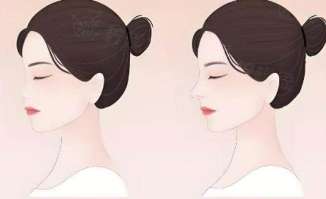 廣州麗人醫(yī)療美容怎么樣？okostu.com