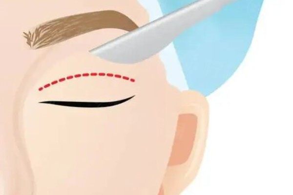 ?？陔p眼皮醫(yī)生排行榜前五www.sanboo.cn