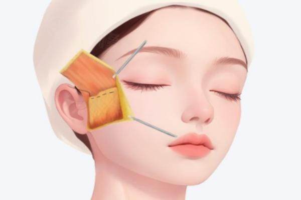 王召東醫(yī)生筋膜固定價格是多少？okostu.com