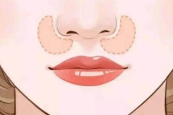 孫蘇寧醫(yī)生做鼻綜合怎么樣？okostu.com