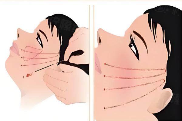 廣州華美整形醫(yī)院醫(yī)生名單介紹www.sanboo.cn