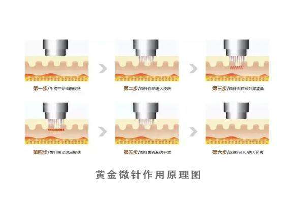 國(guó)內(nèi)美迪邁黃金微針授權(quán)醫(yī)院www.sanboo.cn