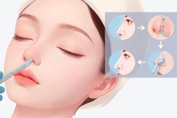 貴陽華美哪位醫(yī)生做鼻子好？www.sanboo.cn