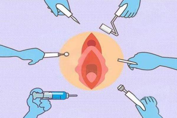 八爪鱼紧缩术哪里做的好