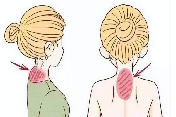 長(zhǎng)沙哪里治富貴包好www.sanboo.cn