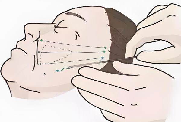 山東做拉皮手術(shù)好的醫(yī)院有哪些