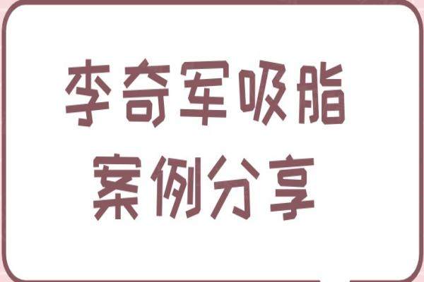 李奇軍吸脂實(shí)例