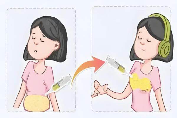 廣州藝星隆胸多少錢