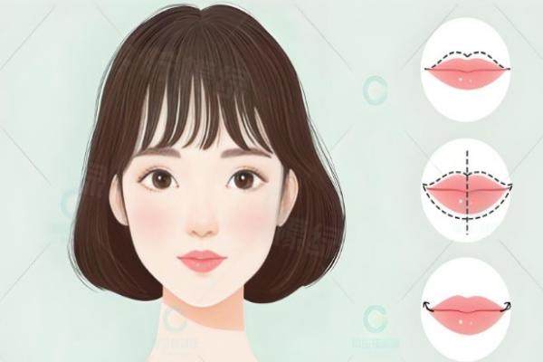 國內(nèi)唇部整形哪家醫(yī)院好