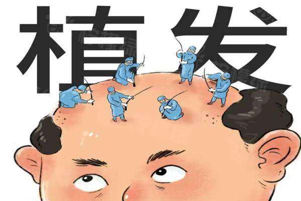 大麥微針植發(fā)大概多少錢www.sanboo.cn