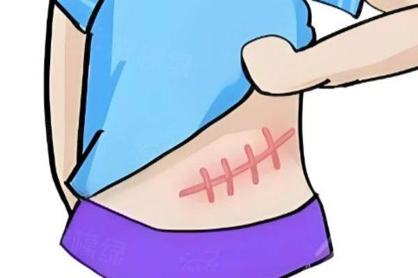 哈爾濱疤痕修復(fù)地址在哪