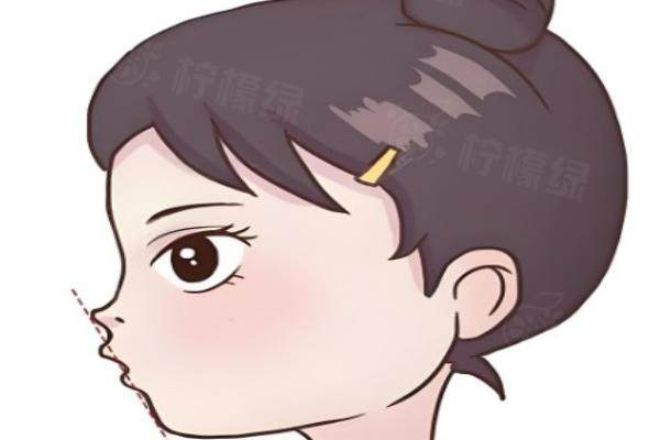 南京裴炳萬(wàn)院長(zhǎng)隆胸怎么樣