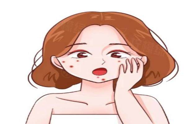 杭州祛痘醫(yī)生推薦