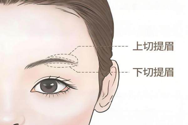 國內提眉手術醫(yī)院排名前十