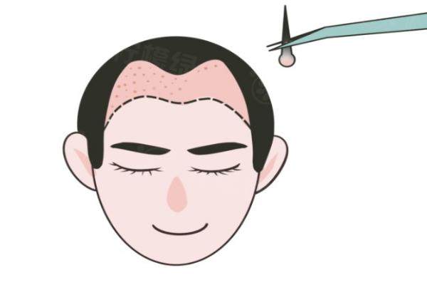 濟(jì)南海峽高國強(qiáng)院長