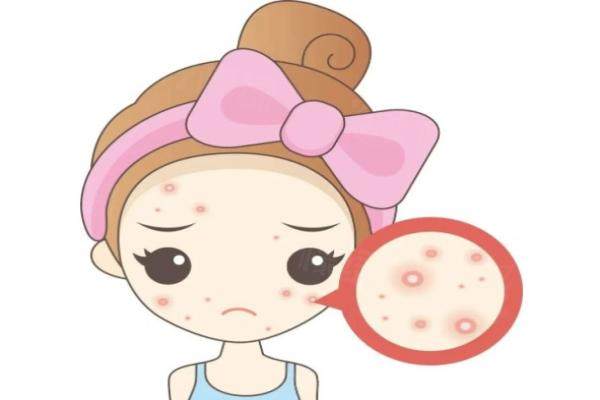 杭州哪家醫(yī)院做祛痘好