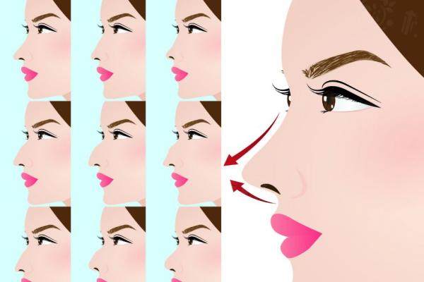 胡柏醫(yī)生隆鼻技術(shù)