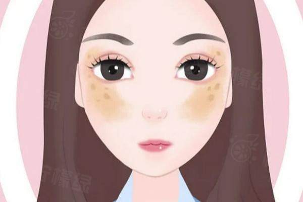 保定藍山整形醫(yī)院激光祛斑價格